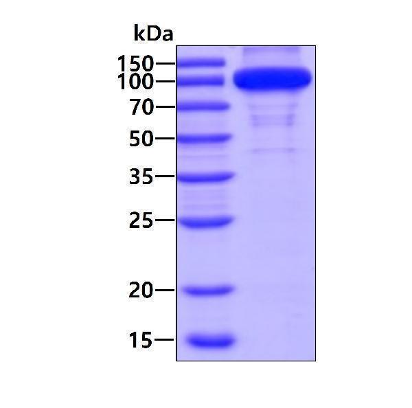 3ug by SDS-PAGE under reducing condition and visualized by coomassie blue stain