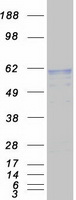 protp15289 arsa human recombinant protein