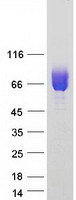 protp15509 csf2ra human recombinant protein