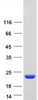 Coomassie blue staining of purified NME1 protein