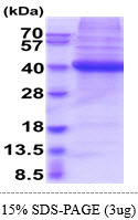 3ug by SDS-PAGE under reducing condition and visualized by coomassie blue stain