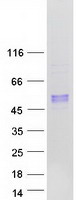 protp15848 arsb human recombinant protein