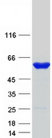 protp16118 pfkfb1 human recombinant protein