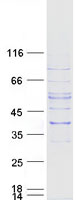 Coomassie blue staining of purified SLC25A16 protein
