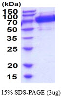 3ug by SDS-PAGE under reducing condition and visualized by coomassie blue stain