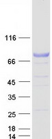 protp16278 glb1 human recombinant protein