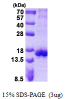 3ug by SDS-PAGE under reducing condition and visualized by coomassie blue stain