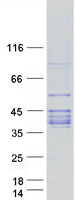 protp16442 abo human recombinant protein