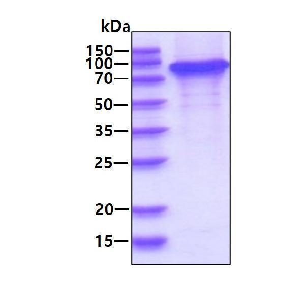 3ug by SDS-PAGE under reducing condition and visualized by coomassie blue stain