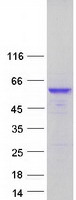 Coomassie blue staining of purified CPE protein