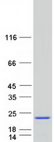 Coomassie blue staining of purified STMN1 protein