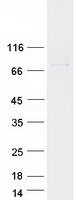 Coomassie blue staining of purified ZNF26 protein