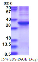 3ug by SDS-PAGE under reducing condition and visualized by coomassie blue stain.