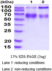 3ug by SDS-PAGE under reducing condition and visualized by coomassie blue stain.