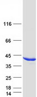 Coomassie blue staining of purified AKR1C4 protein