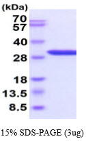 protp17931 sdspage human galectin 3 recombinant protein