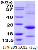 3ug by SDS-PAGE under reducing condition and visualized by coomassie blue stain.