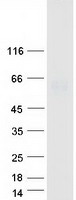 Coomassie blue staining of purified UGT1A6 protein
