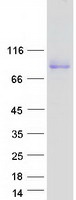 Coomassie blue staining of purified VCAM1 protein