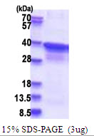 3ug by SDS-PAGE under reducing condition and visualized by coomassie blue stain.
