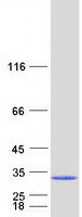 Coomassie blue staining of purified NDUFV2 protein