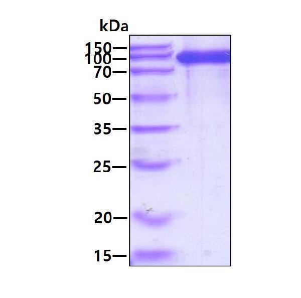 3ug by SDS-PAGE under reducing condition and visualized by coomassie blue stain