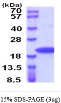 3ug by SDS-PAGE under reducing condition and visualized by coomassie blue stain