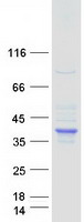 protp20132 sds human recombinant protein