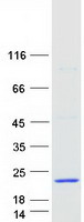 Coomassie blue staining of purified ALOX5AP protein