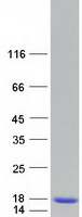 Coomassie blue staining of purified PVALB protein