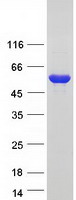 protp20711 dopa decarboxylase ddc human recombinant protein