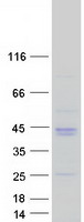 protp20774 oif ogn human recombinant protein