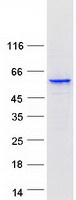 Coomassie blue staining of purified CYP3A5 protein