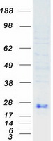 protp20827 ephrin a1 efna1 human recombinant protein