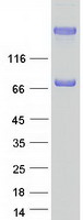Coomassie blue staining of purified COL9A1 protein