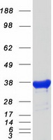 protp21695 gpd1 human recombinant protein