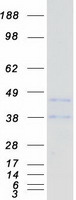 Coomassie blue staining of purified CD72 protein