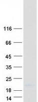 Coomassie blue staining of purified SPRR2E protein