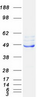 Coomassie blue staining of purified FECH protein
