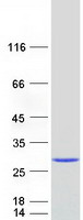 protp22914 beta crystallin s crygs human recombinant protein