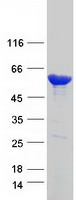 Coomassie blue staining of purified CES1 protein