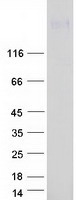 protp23634 atp2b4 human recombinant protein