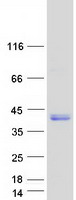 protp23942 prph2 human recombinant protein