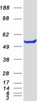 protp24298 alanine transaminase gpt human recombinant protein