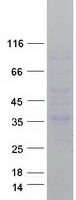 Coomassie blue staining of purified CRHBP protein