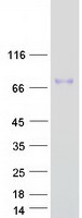 Coomassie blue staining of purified COL8A2 protein