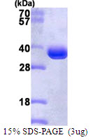 3ug by SDS-PAGE under reducing condition and visualized by coomassie blue stain.