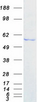 protp26196 ddx6 human recombinant protein