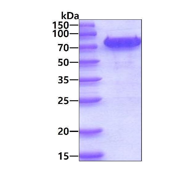 3ug by SDS-PAGE under reducing condition and visualized by coomassie blue stain