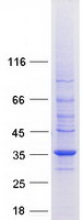 protp27105 stom human recombinant protein